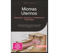 Miomas Uterinos: Diagnóstico, Síntomas y Tratamiento en Ginecología