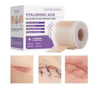 mivceklw Silicone Scar Tape Sheets, Adhesive Healing Strips for Burn Cut Wound Recovery, Skin-Friendly Scar Care Wrap for Daily Use, Gym, Workouts, Outdoor Travel, 1.57x59.06 Inches