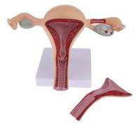 Modèle d'utérus et d'ovaires, modèle d'appareil reproducteur féminin, outil pédagogique utérin, ovarien et vaginal avec organes amovibles, pour cabinet médical.