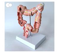 Modello 3D di anatomia umana - Riproduzione del sistema digestivo del colon per l'educazione di anatomia e fisiologia