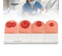 Modello Addestramento For La Cura Della Stomia 4 Pezzi, Set Modelli Addestramento Realistico For Stomia, Simulatore Urostomia For Colostomia Ileostomia Appiccicosa E Simulatore Stomia Ad Anello