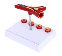 Modello Anatomico Cardiovascolare Umano in Pvc, da Tavolo Multicolore | Mostra Trombi e Stenosi, per Formazione Clinica e Studenti di Scienze della Salute