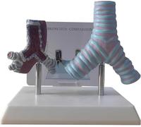 Modello anatomico comparativo del fumatore e del bronco sano | Modello didattico patologico della bronchite respiratoria umana for la formazione in aula di laboratorio for studenti
