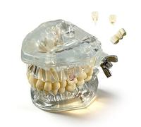 Modello anatomico con denti rimovibili, modello di impianto dentale, modello di tipodonto dentale con 28 denti staccabili per scopi didattici.(White)