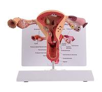Modello anatomico degli organi riproduttivi femminili - Modello anatomico dell'utero e dell'ovaio umano a grandezza naturale per l'educazione medica