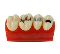 Modello anatomico dei Denti dentali Denti Denti e Chiusura della scanalatura Modello di insegnamento Modello di dimostrazione del Dente Strumento per l'educazione del paziente