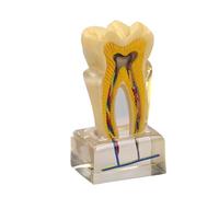 Modello anatomico dei denti in PVC trasparente ingrandito U6X con struttura realistica Dente anatomico per insegnamento in classe insegnamento studente insegnamento