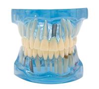 Modello Anatomico dei Denti, Modello Didattico per Lo Studio dei Denti Modello Dimostrativo di Protesi Dentale Trasparente per L'educazione del Paziente