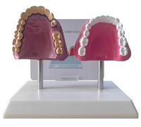 Modello Anatomico Dei Denti Orali Umani Fumatori Denti Sani Comparativi