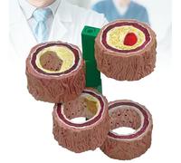 Modello Anatomico Dei Vasi Sanguigni, Modello di Aterosclerosi, Modello di Arteriosclerosi a 4 Stadi, Modello Anatomico di Organi Umani per Sussidio Alla Formazione per L'insegnamento Medico