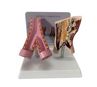 Modello anatomico dei vasi sanguigni Umani con Esposizione comparativa di vasi sani e patologici dei Fumatori, con Struttura Anatomica dettagliata e accurata per Uso educativo