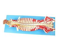 Modello Anatomico Del Canale Vertebrale Della Colonna Vertebrale Umana, Che Mostra Le Strutture Del Cervello E Dei Nervi Cerebellari. I Nervi Spinali Nel Canale Vertebrale Sono Utilizzati