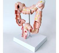 Modello Anatomico Del Colon Umano, Replica Anatomia E Fisiologia, Strumento Studio Del Sistema Digestivo Umano, Modello Patologia Dell'intestino Crasso A Grandezza Naturale 1:1 For L'educazione