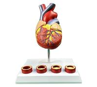 Modello anatomico del Cuore a grandezza Naturale, con 2 Parti Staccabili e 4 vasi trombotici per Modelli didattici Comunicazione Medico-paziente