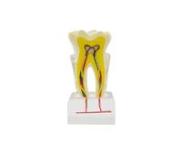 Modello anatomico del dente 6X Modello di patologia Modello di anatomia del nervo del dente Modello di dente for l'educazione del paziente Modello di canale radicolare Modello di dente