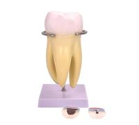 Modello anatomico del dente molare staccabile per l'esposizione della ricerca scientifica in contesti medici e clinici denti standard