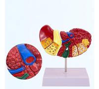 Modello anatomico del fegato 1:1 Modello patologico del fegato Texture chiara Caratteristiche patologiche evidenti con base per medico ufficio anatomia modello scuola insegnamento display