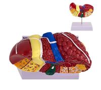 Modello Anatomico del Fegato,Modello del Fegato - Modello di patologia epatica a trama chiara | Modello di patologia pedagogica del fegato, modello di fegato con display versatile e luminoso per