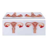 Modello anatomico del processo di fecondazione Modello del processo di fecondazione umana Sezione dell'organo riproduttivo femminile Modelli di utero e ovaie Strumento didattico
