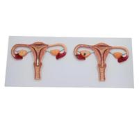 Modello anatomico del processo di fecondazione, modello di sezione trasversale degli organi riproduttivi femminili come utero, ovaie, tube di Falloppio, ecc., for lo studio della scienza medica