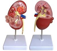 Modello anatomico del rene funzionante, 2 parti staccabili e 24 etichette digitali, guida anatomica for dimostrazione educativa