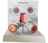Modello anatomico del sistema respiratorio umano, modello di struttura tracheale e bronchiale for asma, modello dimostrativo di insegnamento medico for l'apprendimento in egli studenti