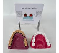 Modello anatomico della cavità orale con caratteristiche patologiche | Modello comparativo tra denti fumatori e denti sani, replica didattica dentale for studenti ed educazione alla salute orale