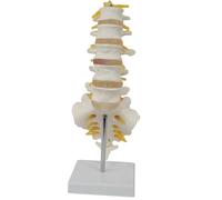 Modello anatomico della colonna lombare con sacro e nervi spinali, replica didattica della sezione lombosacrale con nervi e ernia del disco, include base for esposizione didattica medica.