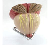 Modello anatomico della ghiandola prostatica maschile 2X, modello staccabile in 4 parti, modello medico for l'insegnamento dimostrativo dell'apprendimento, perfetto for lo studio dell'anatomia