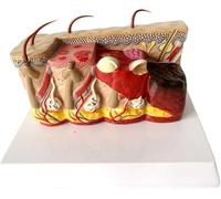 Modello anatomico della pelle ustionata umana, modello anatomico degli organi della pelle e dei capelli, anatomico medico for lo studio scientifico o strumento didattico for l'educazione del