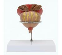 Modello anatomico della prostata umana, modello della prostata maschile, ingrandimento 2X, modelli staccabili in 4 parti, for l'insegnamento dimostrativo dell'apprendimento medico.