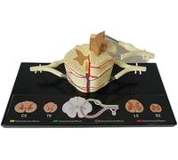 Modello anatomico della sezione trasversale del midollo spinale | Modello anatomico del segmento della colonna vertebrale umana e vasi sanguigni, for l'insegnamento nelle scuole di medicina