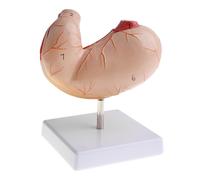 Modello Anatomico Della Struttura Dello Stomaco Umano Rimovibile In 2 Parti