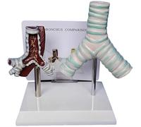 Modello anatomico della trachea umana, modello comparativo tra trachea fumante e trachea normale, anatomia degli organi della struttura del sistema respiratorio, for la visualizzazione