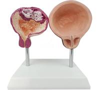 Modello anatomico della vescica umana maschile, strumento didattico for l'urologia, visualizzazione comparativa di modelli sani e patologici, for la ricerca didattica medica.