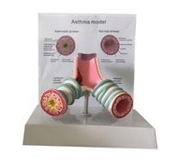 Modello anatomico dell'asma - Modello bronchiale del sistema respiratorio per studio e insegnamento degli studenti