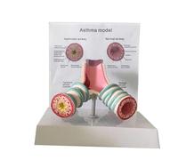 Modello anatomico dell'asma umano, modello bronchiale del sistema respiratorio, modello di caso tracheale umano per gli studenti Studio Display Modello didattico