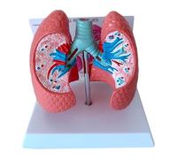 Modello anatomico delle patologie polmonari, modello anatomico degli organi umani, in scala 1:1, a grandezza naturale, ausilio didattico per la dimostrazione del confronto tra polmoni sani e patologic