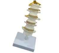 Modello anatomico delle vertebre lombari umane della colonna vertebrale con 5 vertebre sacrum e nervi spinali per dimostrare la colonna vertebrale