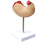 Modello anatomico dello stomaco Modelli scientifici dell'anatomia umana Struttura dell'apparato digerente umano Modello dell'organo digerente for supporto didattico Dimostrazione