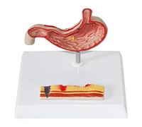 Modello anatomico dello stomaco per l'educazione medica, ulcera e gastrite | Modello anatomico di alta qualità per allenamento medico - perfetto per comprendere ulcere e