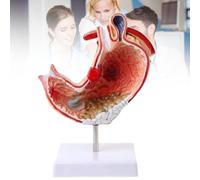 Modello anatomico dello stomaco umano con diaframma, strumento visivo per lesioni dello stomaco Modello anatomico per l'insegnamento delle scienze Modello didattico per l'insegnamento