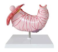 Modello anatomico dello stomaco umano Modello di stomaco Modello di sistema digestivo Modello educativo Modello di gastrite Modello di lesione gastrica Modello di patologia gastrica Gastrite