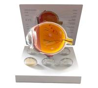 Modello anatomico dell'occhio umano Anatomico Patologico Bulbo oculare Strumento di insegnamento Realistico Patologico Bulbo oculare Anatomia Glaucoma Modello dell'occhio