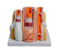 Modello anatomico di arteria umana, modello anatomico di vaso sanguigno, modello cardiovascolare artero-venoso, modello vascolare anatomico di aterosclerosi vascolare, sussidi didattici cardiovascolar