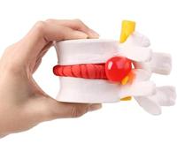 Modello anatomico di ernia del disco lombare umano, modello anatomico portatile della colonna lombare regolabile 1,5 volte, visualizzato, resistente, leggero, for l'insegnamento