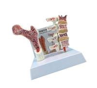 Modello Anatomico Di Osteoporosi Verteebra Per L'Educazione All'Anatomia E 'Studio Della Colonna Vertebrale Del Paziente