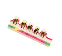 Modello anatomico di patologia parodontale adulta codificata a colori | Modello colorato realistico di anatomia del PVC per l'istruzione e la dimostrazione di insegnamento per l'impostazione