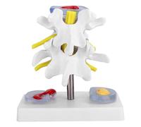 Modello Anatomico Lombare, Modello di Colonna Vertebrale Umana, Modello di Ernia Del Disco Lombare Umano, Modello di Vertebra Lombare per Modello Medico Didattico