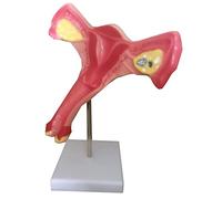 Modello Anatomico Medico Dell'utero-Ovario - Modello Anatomico Dell'organo Riproduttivo - Modello Di Studio, Modello Patologico Dell'utero Umano